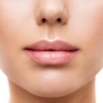 Dermal Fillers For Lip Wrinkles, Fine Lines, And Also Lip Creases